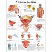 A glândula Prostatica, 50x67 cm, Versao Papel