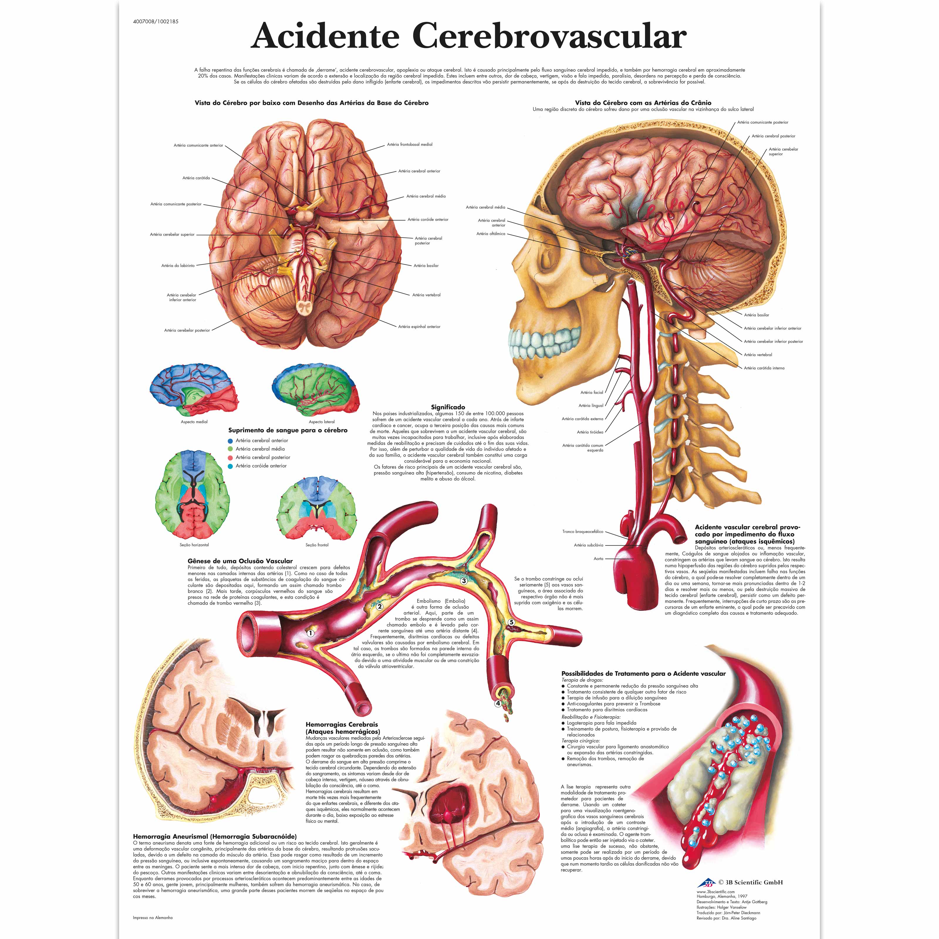 Acid. Cerebrovascular, 50x67 cm, Versao Papel