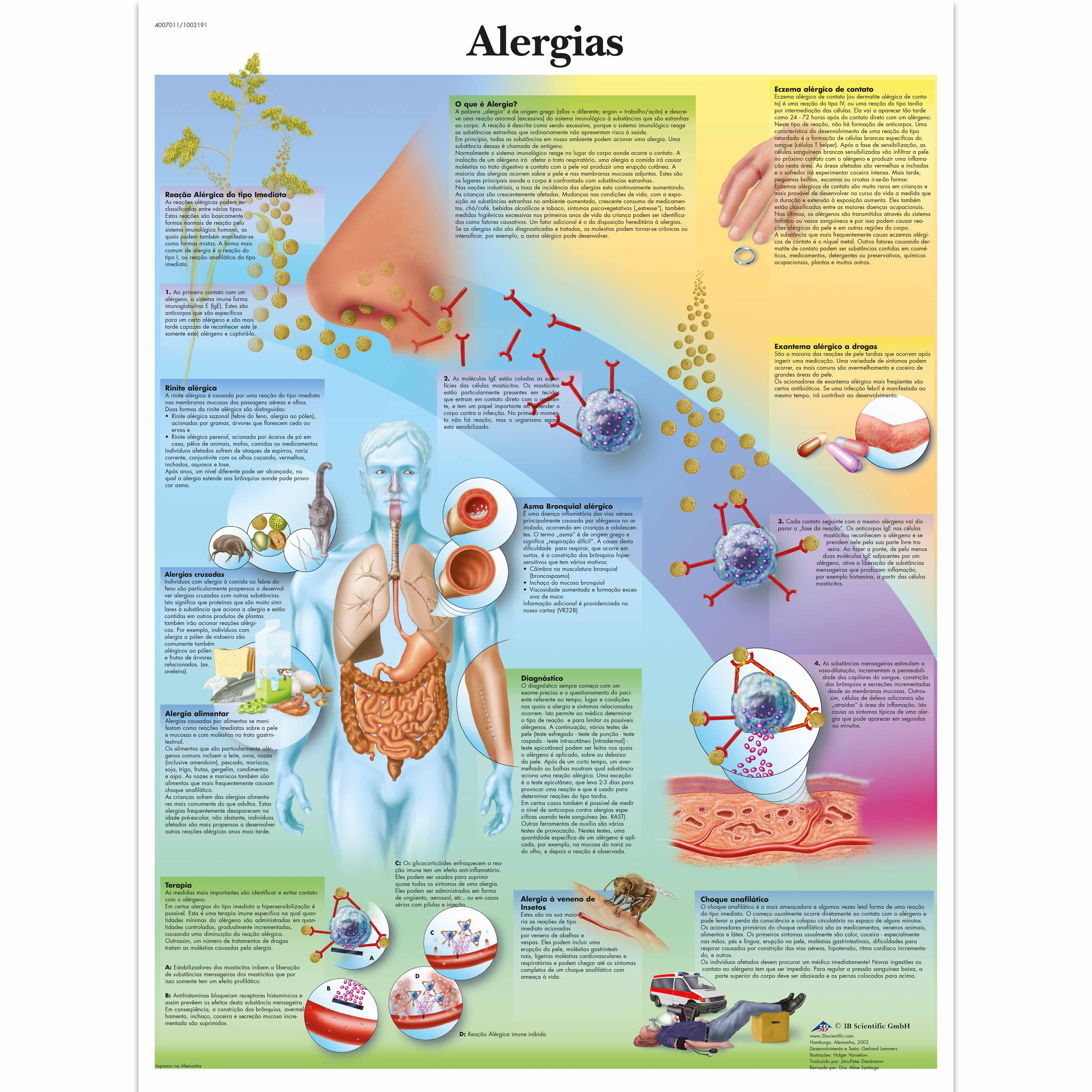 Alergias, 50x67 cm, Laminado