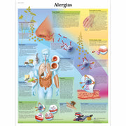 Alergias, 50x67 cm, Versao Papel