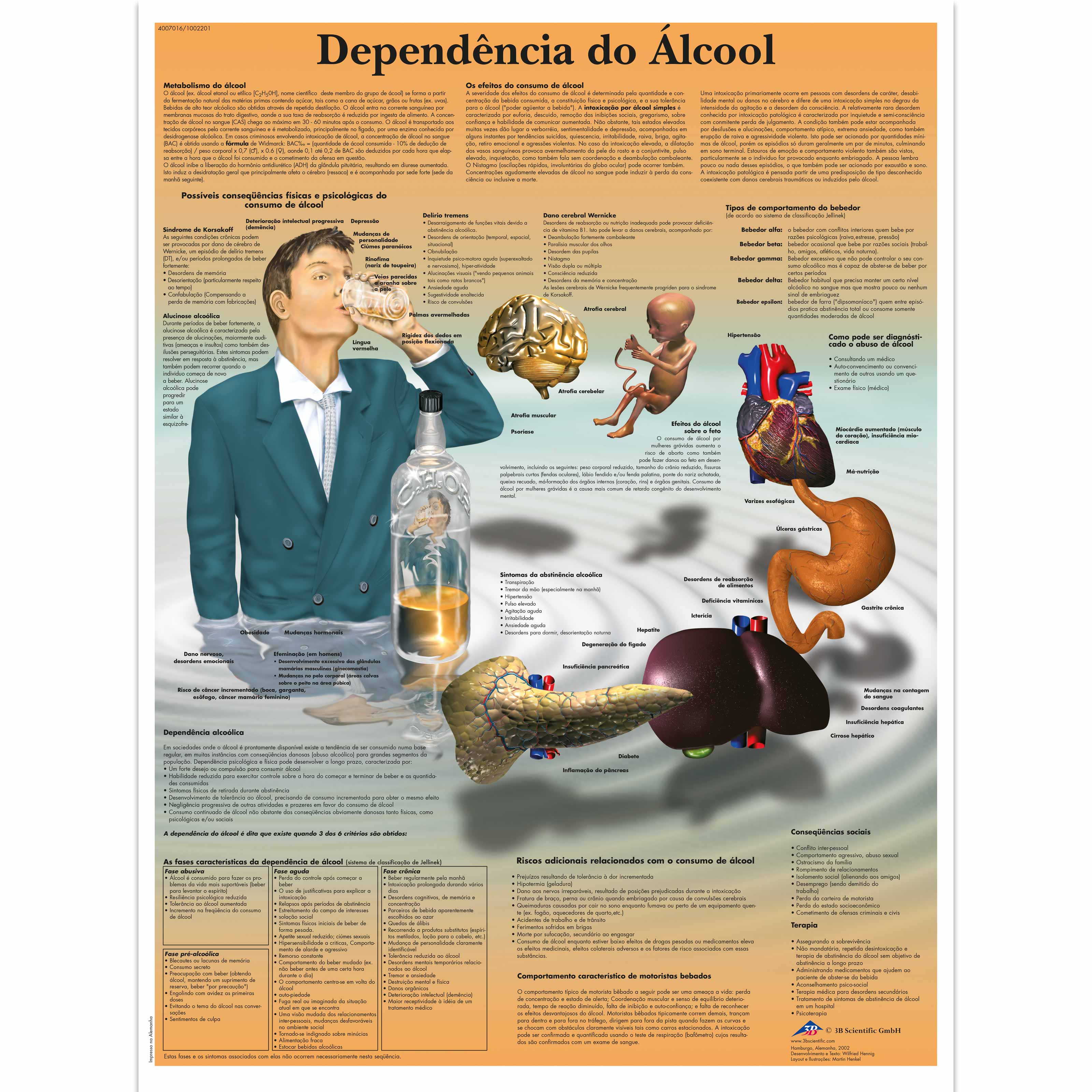Dependência do alcool, 50x67 cm, Versao Papel
