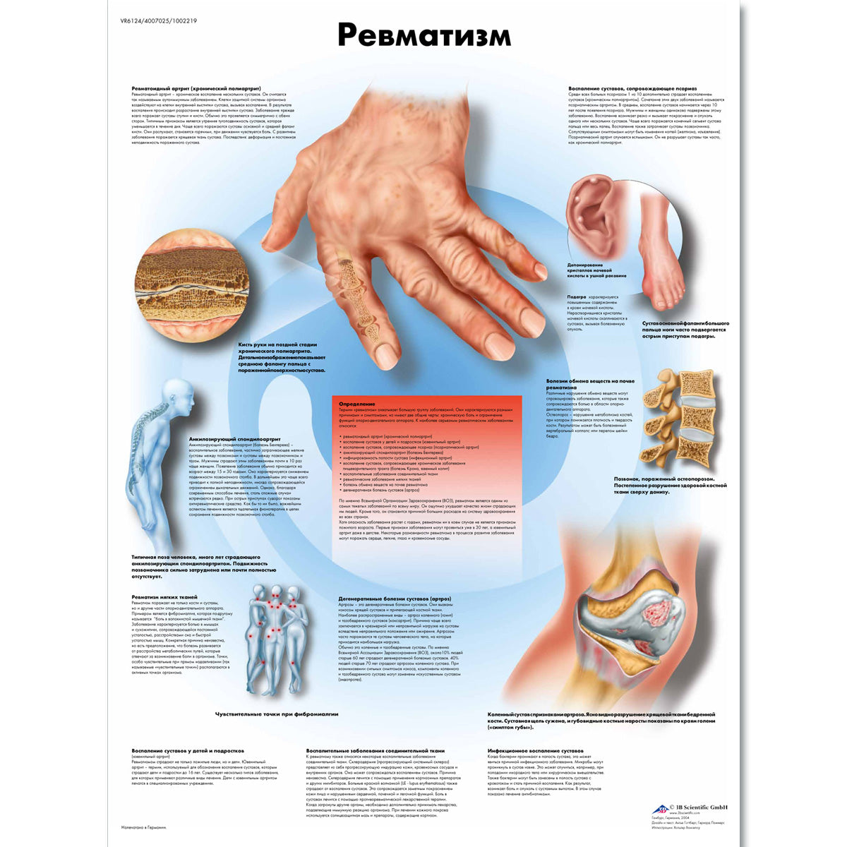 Rheumatic Diseases Chart