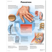 Rheumatic Diseases Chart