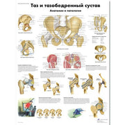 Pelvis and Hip Chart - Anatomy and Pathology