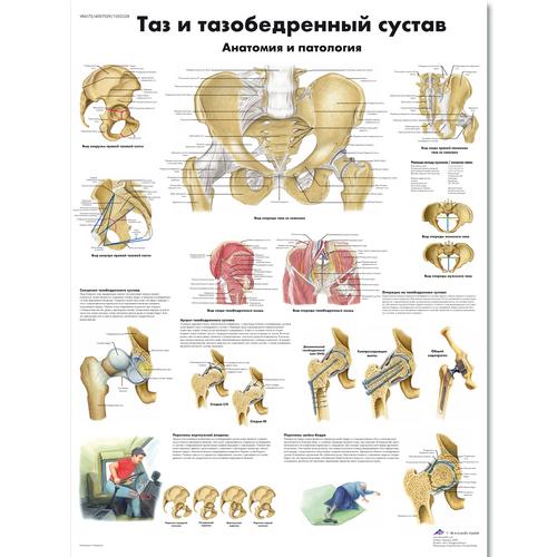 Pelvis and Hip Chart - Anatomy and Pathology