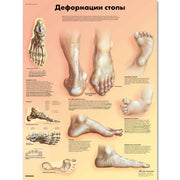 Deformities of the Feet Chart