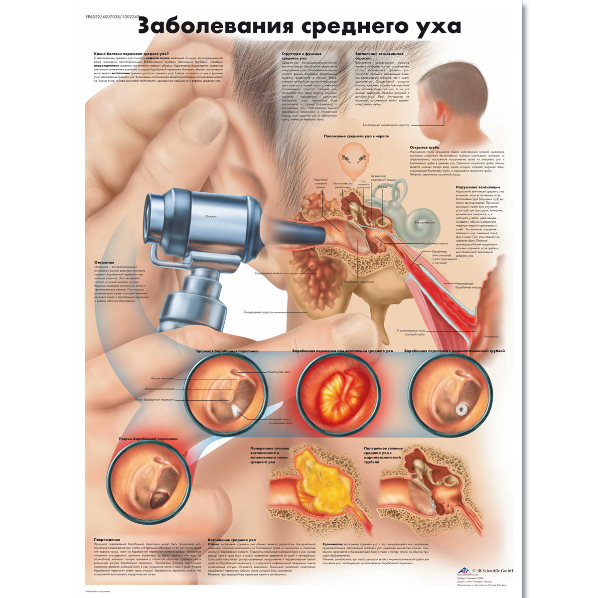 Diseases of the Middle Ear Chart