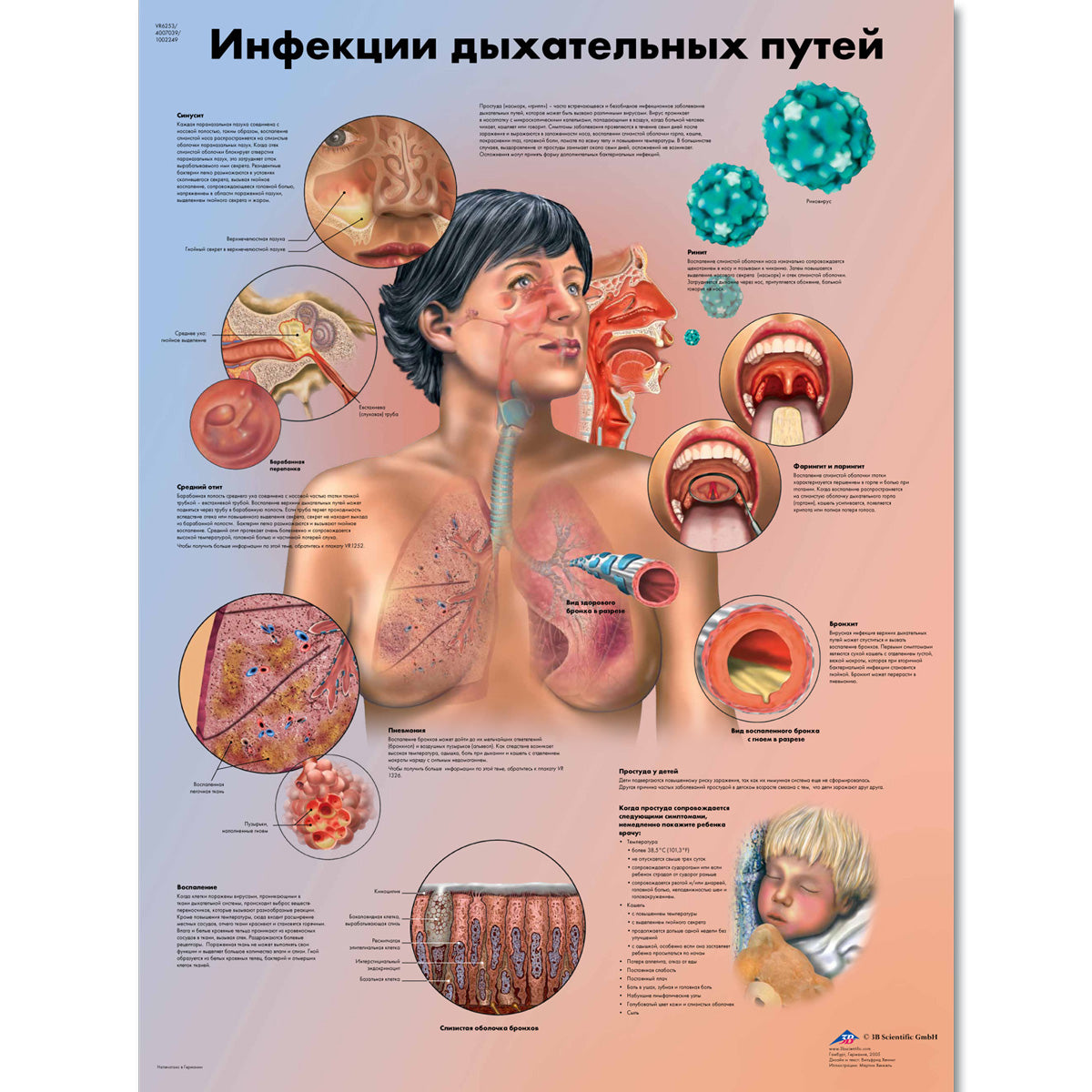 Respiratory Tract Infections Chart
