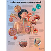 Respiratory Tract Infections Chart