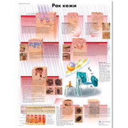 Skin Cancer Chart