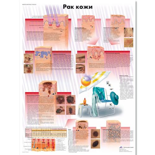 Skin Cancer Chart