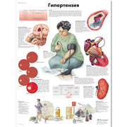 Hypertension Chart