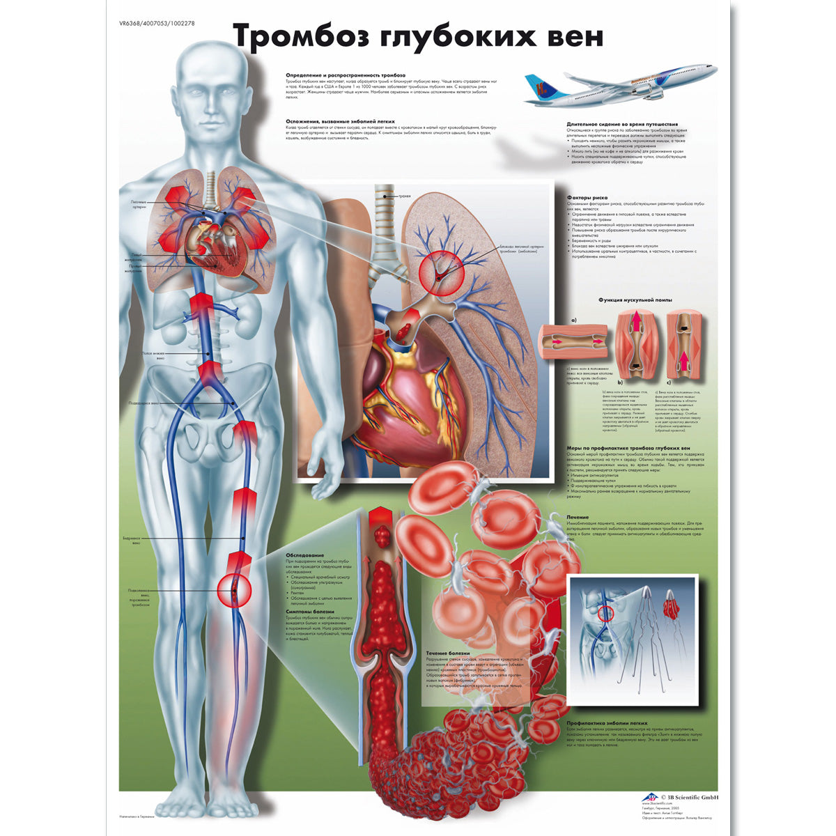 Deep Vein Thrombosis Chart