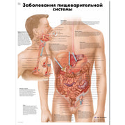 Diseases of the Digestive System Chart