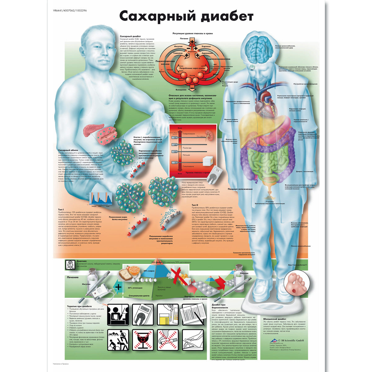 Diabetes mellitus Chart