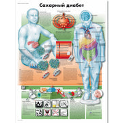 Diabetes mellitus Chart