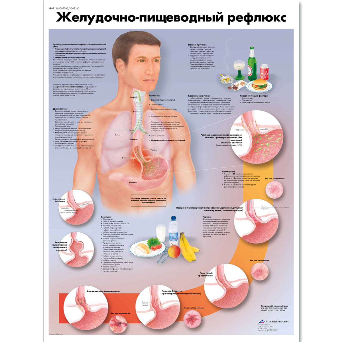 Gastroesophageal reflux disease Chart