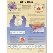 HIV and AIDS Chart