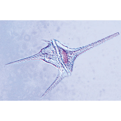 Protozoa - Spanish Slides