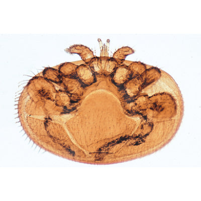Arachnoidea and Myriapoda - French