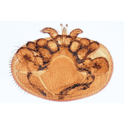 Arachnoidea and Myriapoda - Spanish