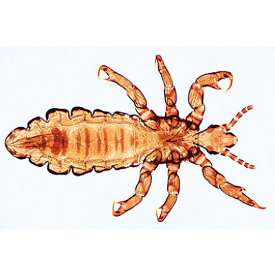 Insect (Insecta) - Spanish