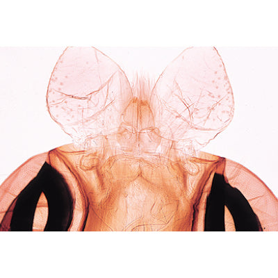 Insect (Insecta) - Spanish