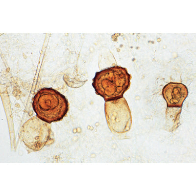 Fungi and Lichen - Portuguese Slides