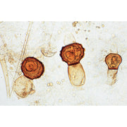 Fungi and Lichen - German Slides