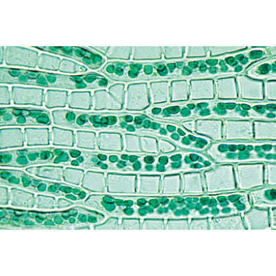 Bryophyta (Liverworts and Mosses) - German Slides