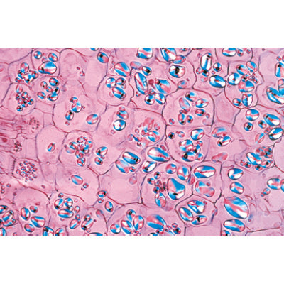 Angiospermae IV. Stems - French