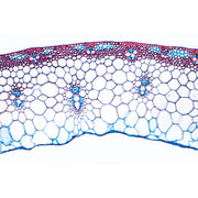 Angiospermae IV. Stems - Portuguese Slides