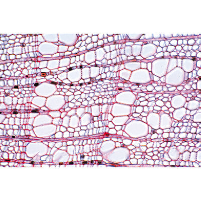 Angiospermae IV. Stems - Portuguese Slides