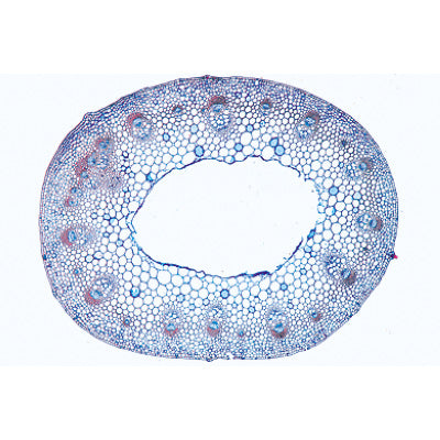 Angiospermae IV. Stems - Spanish