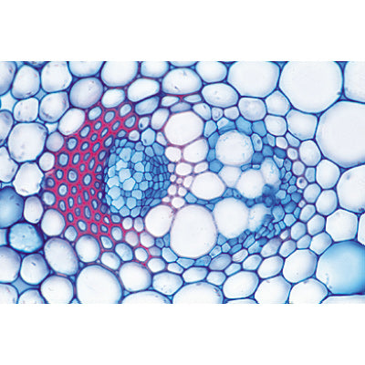 Angiospermae IV. Stems - German Slides