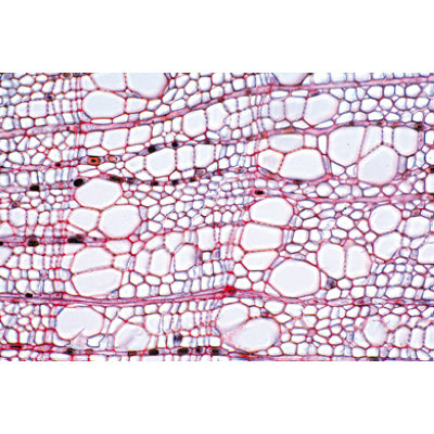 Angiospermae IV. Stems - German Slides