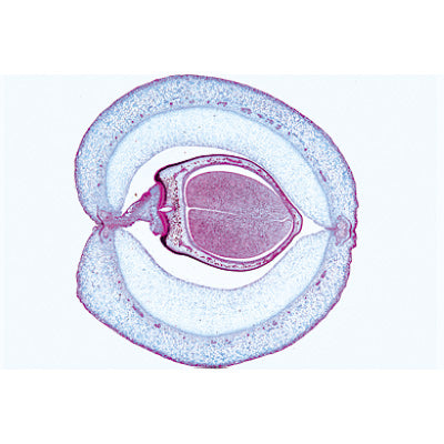 Angiospermae VII. Fruits and Seeds - French
