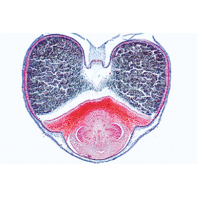 Angiospermae VII. Fruits and Seeds - Portuguese Slides