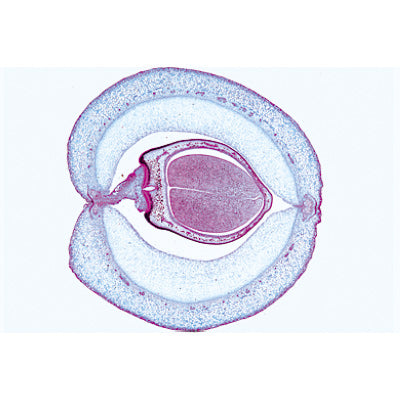 Angiospermae VII. Fruits and Seeds - Spanish