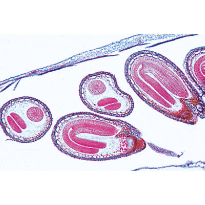 Angiospermae VII. Fruits and Seeds - Spanish
