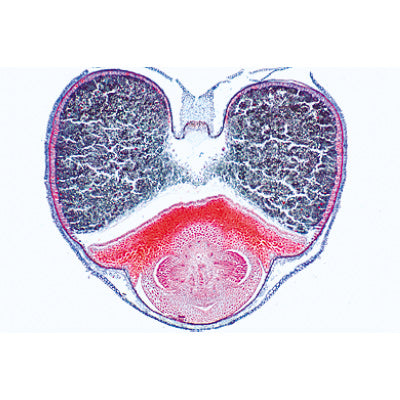 Angiospermae VII. Fruits and Seeds - Spanish
