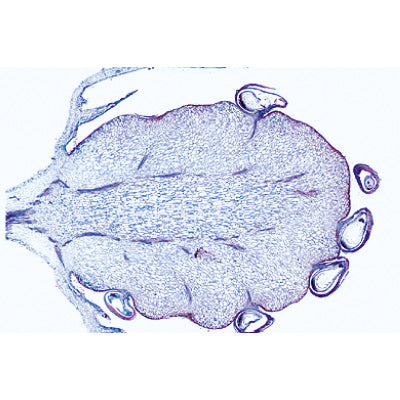 Angiospermae VII. Fruits and Seeds - Spanish