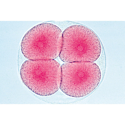 Sea Urchin Embryology (Psammechinus miliaris) - French