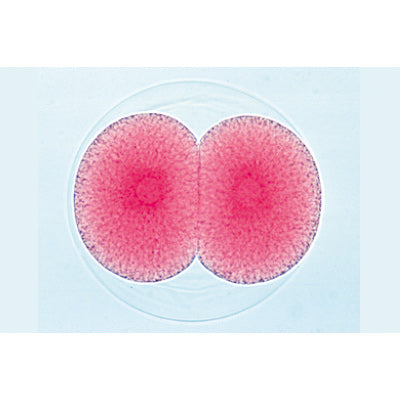 Sea Urchin Embryology (Psammechinus miliaris) - German Slides