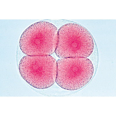 Sea Urchin Embryology (Psammechinus miliaris) - German Slides