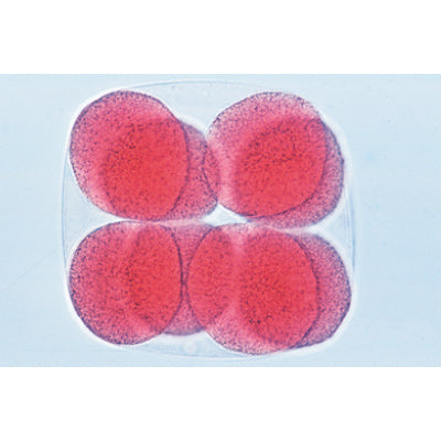 Sea Urchin Embryology (Psammechinus miliaris) - German Slides