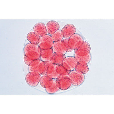 Sea Urchin Embryology (Psammechinus miliaris) - German Slides