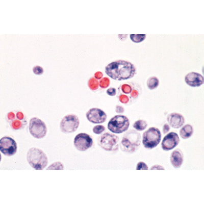 Fungi and Lichen - English Slides