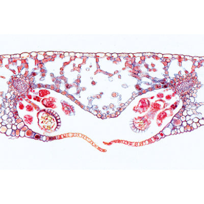 Pteriodophytes (Ferns and Fern Allies) - English Slides