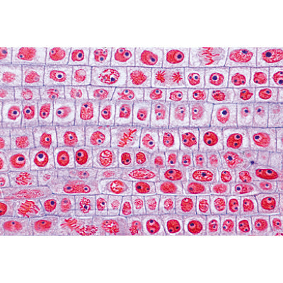Angiospermae Roots Set- 15 Slides